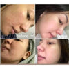 Rosmar 24Hours Kagayaku Rejuvenating Kit & KAGAYAKU EXTREME PEELING & WHITENING KIT